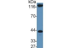 Detection of IL11Ra in Rat Serum using Polyclonal Antibody to Interleukin 11 Receptor Alpha (IL11Ra) (IL11RA anticorps  (AA 194-329))