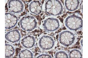 Image no. 3 for anti-Differentially Expressed in FDCP 6 Homolog (DEF6) antibody (ABIN1497808) (DEF6 anticorps)