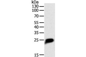 Western Blot analysis of Human liver cancer tissue using CRP Polyclonal Antibody at dilution of 1:1400 (CRP anticorps)