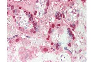 Human Placenta: Formalin-Fixed, Paraffin-Embedded (FFPE).