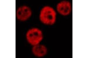 ABIN6277019 staining  Hela cells by IF/ICC. (RPS19 anticorps  (Internal Region))