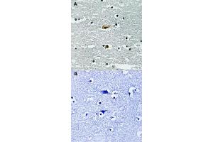 Immunohistochemical staining of human brain tissue by STK39 (phospho S309) polyclonal antibody  without blocking peptide (A) or preincubated with blocking peptide (B).