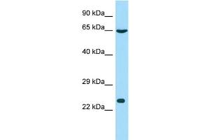 Host: Rabbit Target Name: GSTCD Sample Type: Hela Whole cell lysates Antibody Dilution: 1. (GSTCD anticorps  (N-Term))