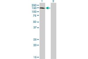 Western Blot analysis of ABL2 expression in transfected 293T cell line by ABL2 monoclonal antibody (M03), clone 6D5.