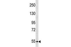 PCSK4 antibody western blot analysis in SK-BR-3 lysate. (PCSK4 anticorps  (AA 168-196))