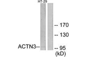 Western blot analysis of extracts from HT-29 cells, using ACTN3 Antibody. (ACTN3 anticorps  (AA 1-50))