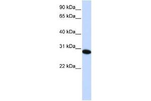 PHF19 antibody used at 0. (PHF19 anticorps  (C-Term))
