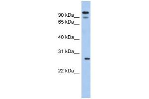 VDAC3 antibody used at 1 ug/ml to detect target protein.