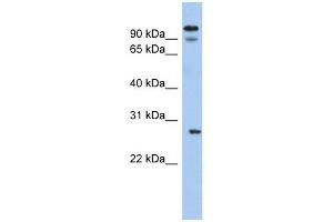VDAC3 antibody used at 1 ug/ml to detect target protein. (VDAC3 anticorps  (N-Term))