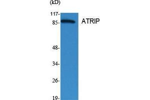 Western Blot (WB) analysis of specific cells using ATRIP Polyclonal Antibody. (ATRIP anticorps  (Tyr783))