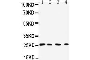 Western Blotting (WB) image for anti-RAB3C, Member RAS Oncogene Family (Rab3c) (AA 204-217), (C-Term) antibody (ABIN3042555) (Rab3c anticorps  (C-Term))