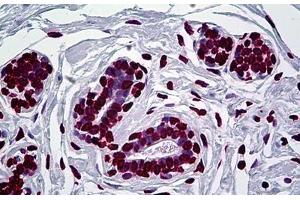 Human Breast: Formalin-Fixed, Paraffin-Embedded (FFPE) (EN1 anticorps  (AA 266-392))