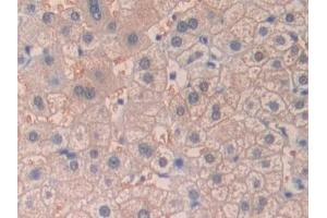 Detection of DHH in Human Liver Tissue using Polyclonal Antibody to Hedgehog Homolog, Desert (DHH)