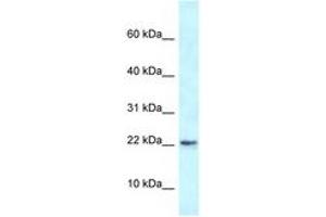 Image no. 1 for anti-RNA Binding Motif Protein 3 (RBM3) (AA 23-72) antibody (ABIN6747435) (RBM3 anticorps  (AA 23-72))