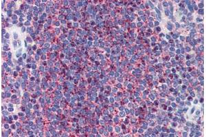 Human Spleen (formalin-fixed, paraffin-embedded) stained with LIN28 antibody ABIN462196 followed by biotinylated goat anti-rabbit IgG secondary antibody ABIN481713, alkaline phosphatase-streptavidin and chromogen.