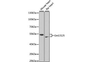 Western blot analysis of extracts of various cell lines, using Gm13125 antibody (ABIN6127294, ABIN6141172, ABIN6141175 and ABIN6216319) at 1:1000 dilution. (Pramel15 anticorps  (AA 1-477))