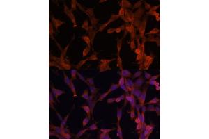 Immunofluorescence analysis of NIH-3T3 cells using UBE2G2 antibody (ABIN6130769, ABIN6149798, ABIN6149799 and ABIN6214653) at dilution of 1:100.