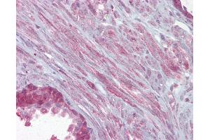 Anti-KCNMA1 antibody IHC of human prostate.