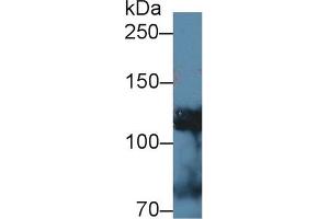 Detection of ADD1 in Mouse Testis lysate using Polyclonal Antibody to Alpha Adducin (ADD1)