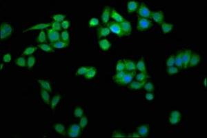Immunofluorescence staining of PC-3 cells with ABIN7158949 at 1:266, counter-stained with DAPI.