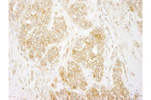 Immunohistochemistry (IHC) image for anti-Nuclear Factor-kB p65 (NFkBP65) (AA 501-551) antibody (ABIN7448771)
