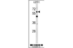 Western blot analysis in U251 cell line lysates (35ug/lane).