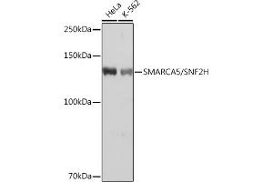 Western blot analysis of extracts of various cell lines, using SM/SM/SNF2H Rabbit mAb (ABIN7270656) at 1:1000 dilution. (SMARCA5 anticorps)
