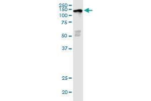 JARID1D monoclonal antibody (M03), clone 4C6.