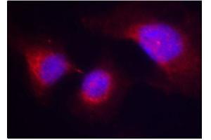 Immunofluorescence (IF) image for anti-Spleen tyrosine Kinase (SYK) (pTyr323) antibody (ABIN1870661) (SYK anticorps  (pTyr323))