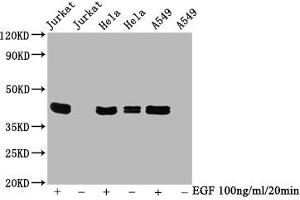 Western Blot Positive WB detected in Jurkat whole cell lysate 72ela whole cell lysate 65549 whole cell lysate(treated with EGF or not) All lanes Phospho-MAPK3 antibody at 0. (Recombinant ERK1 anticorps  (pThr183, pThr202, pThr204, pTyr187))