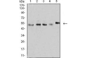 Western blot analysis using CD2 mouse mAb against MOLT4 (1), MCF-7 (2), L1210 (3), U937 (4), and NIH3T3 (5) cell lysate.