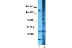 Host:  Rabbit  Target Name:  CNTNAP1  Sample Type:  Fetal Lung  Lane A:  Primary Antibody  Lane B:  Primary Antibody + Blocking Peptide  Primary Antibody Concentration:  1ug/ml  Peptide Concentration:  5ug/ml  Lysate Quantity:  25ug/lane/Lane  Gel Concentration:  0. (CNTNAP1 anticorps  (N-Term))