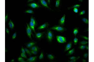 Immunofluorescence staining of Hela Cells with ABIN7127792 at 1:50, counter-stained with DAPI. (Recombinant RHEB anticorps)