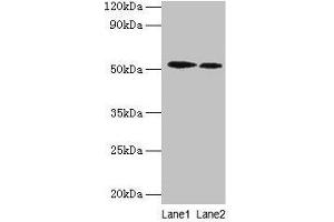 Western blot All lanes: RPS6KB2 antibody at 2 μg/mL Lane 1: EC109 whole cell lysate Lane 2: 293T whole cell lysate Secondary Goat polyclonal to rabbit IgG at 1/15000 dilution Predicted band size: 54, 17 kDa Observed band size: 54 kDa (RPS6KB2 anticorps  (AA 1-210))