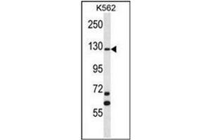 Western blot analysis of MCF2 Antibody (C-term) Cat.