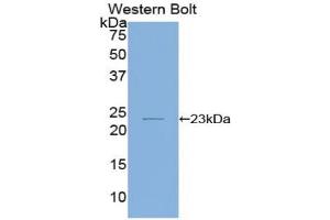 Western blot analysis of the recombinant protein. (IL-1 beta anticorps  (AA 63-247))