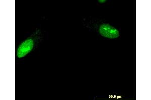Immunofluorescence of monoclonal antibody to ZNF397 on HeLa cell.