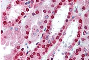Kidney (MBD3 anticorps  (AA 215-230))