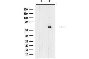 anti-Adrenergic Receptor, alpha 1d (ADRA1D) (C-Term) antibody