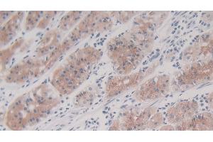 Detection of IL8 in Human Stomach Tissue using Monoclonal Antibody to Interleukin 8 (IL8)