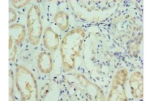 Immunohistochemistry of paraffin-embedded human kidney tissue using ABIN7176713 at dilution of 1:100 (SLC39A6 anticorps  (AA 170-320))
