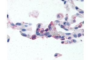 Anti-EMR2 antibody IHC of human lung, neutrophils. (EMR2 anticorps  (N-Term))