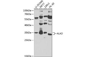 Western blot analysis of extracts of various cell lines, using ALAD antibody (ABIN6129892, ABIN6136750, ABIN6136752 and ABIN6224446) at 1:1000 dilution. (ALAD anticorps  (AA 1-330))