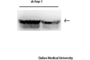 Western Blot (WB) analysis: Please contact us for more details.