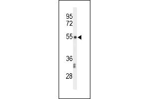 Western blot analysis of CENPI Antibody (Center) (ABIN653571 and ABIN2842947) in CEM cell line lysates (35 μg/lane). (CENPI anticorps  (AA 388-414))