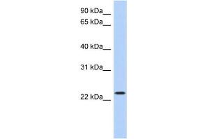 WB Suggested Anti-ATF3 Antibody Titration:  0. (ATF3 anticorps  (Middle Region))