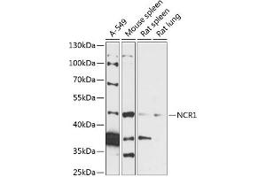 Western blot analysis of extracts of various cell lines, using NCR1 antibody (ABIN7268833) at 1:3000 dilution. (NCR1 anticorps  (AA 151-303))