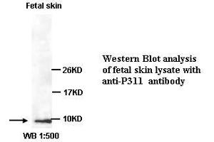 Image no. 1 for anti-Chromosome 5 Open Reading Frame 13 (C5orf13) (C-Term) antibody (ABIN791087) (NREP anticorps  (C-Term))