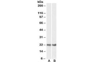 Western blot testing of mouse [A] and rat [B] eye lysates with CRYAB antibody at 0. (CRYAB anticorps)