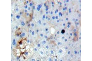 Used in DAB staining on fromalin fixed paraffin-embedded Liver tissue